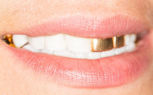 Gold teeth